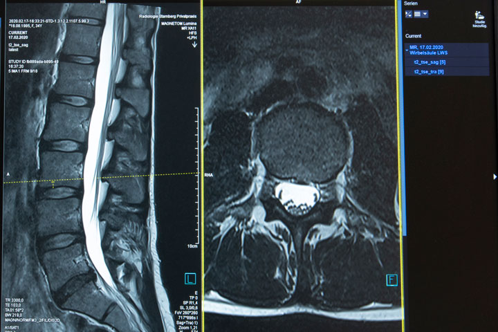 MRT-2-720x480 Roentgen-3